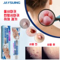 [국내출하] JAYSUING 편평 치료 제거 제거 크림 제거크림, 20g, 4개